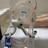 ecmo