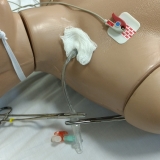 ecmo