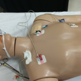 ecmo