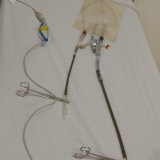 ecmo