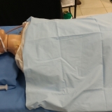 ecmo