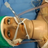 ecmo