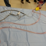 ecmo