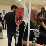 ecmo