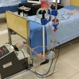 ecmo