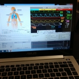 ecmo