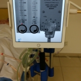 ecmo