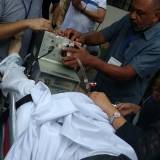 ecmo