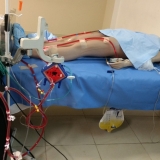ecmo